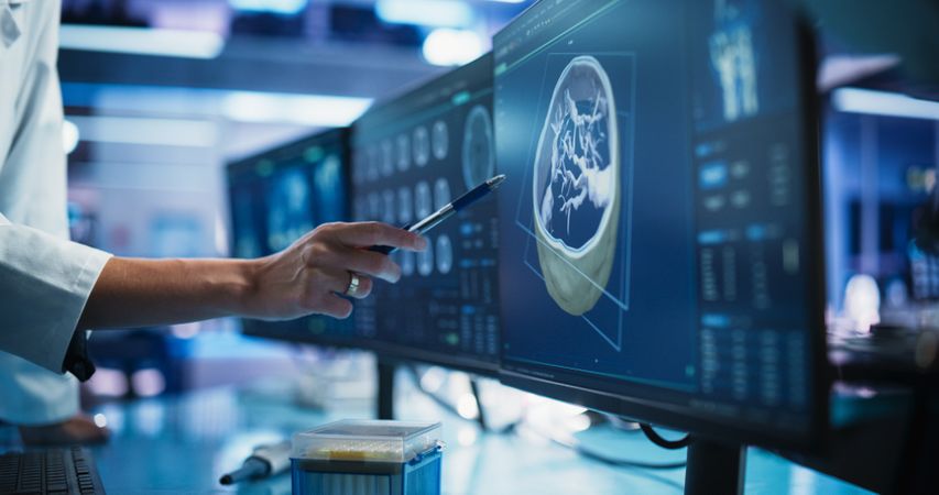 Modern Medical Research Center: Anonymous Doctor Pointing At Desktop Computer Monitor With Software Visualizing Human Brain Based On MRI Scan.