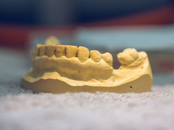 Gypsum cast of human jaw