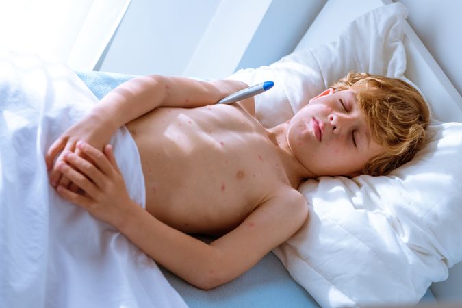 Boy with chickenpox measuring temperature