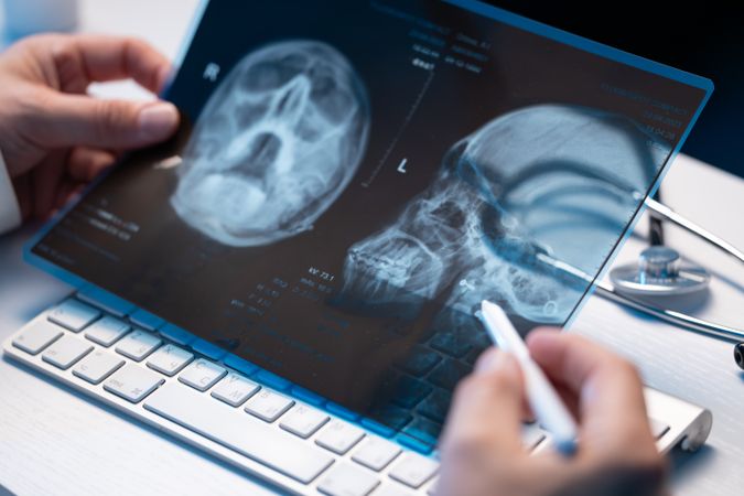 Doctor Examining X Ray in Office