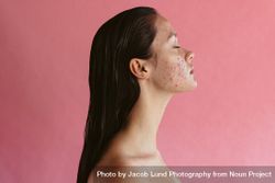 Side view portrait of woman with acne inflammation on pink background 0yYpq0