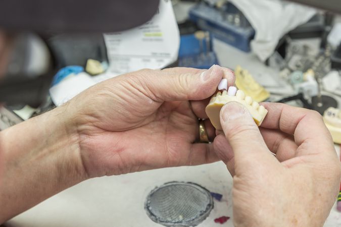 Dental Technician Working On 3D Printed Mold For Tooth Implants