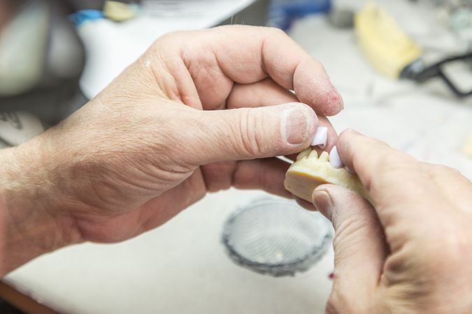 Dental Technician Working On 3D Printed Mold For Tooth Implants